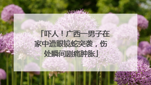 吓人！广西一男子在家中遭眼镜蛇突袭，伤处瞬间剧痛肿胀